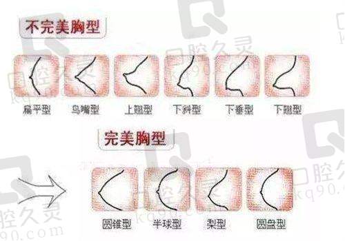 秦皇岛念奴娇医疗美容诊所做双眼皮、超声炮咋样？资质全价格合理，方案还个性化