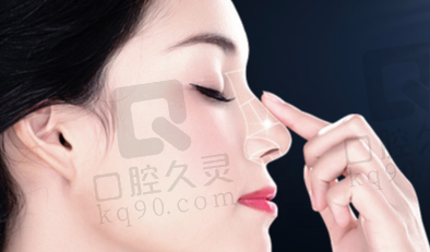 深圳鹏程医院鼻综合整形体验：重塑立体美鼻，改善面部气质，术后效果超满意 