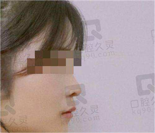 合肥天鹅湖整形，值得选择吗？