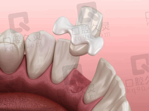 其他项目：从补牙到美白，全方面呵护口腔健康