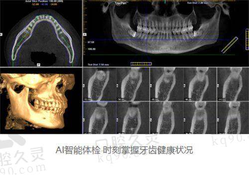美国皓齿美白/瓷贴面/牙冠修复价格也相当亲民，追求容貌你也可以