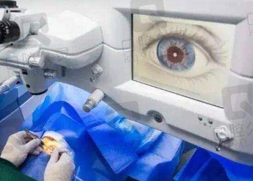 成都普瑞眼科咋样？正规私立技术好，近视手术多样价7800起！