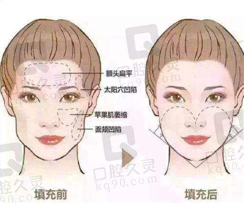 西安西美整形医生排名前10公布！速看赵永政、刘小刚等各擅长啥项目及价格、技术优势