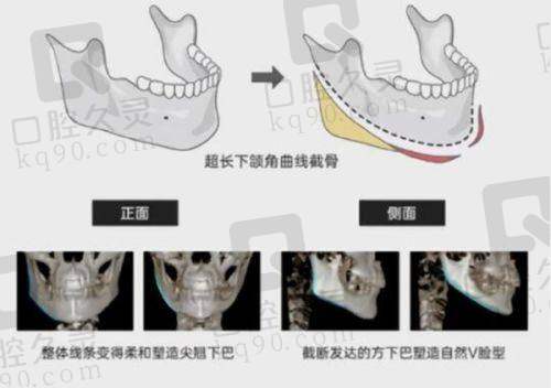 洛阳孔繁荣院长有几个？不同院长助力多样变得更美需求