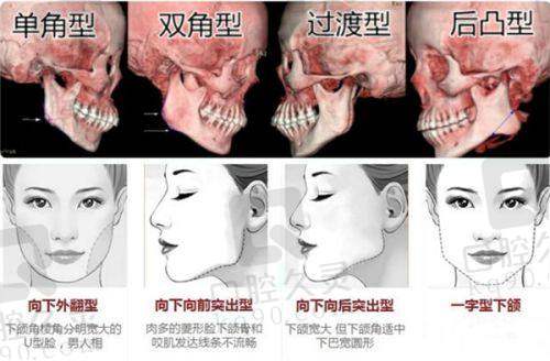 7. 成都铜雀台医美美容医院 - 以鼻整形为擅长领域