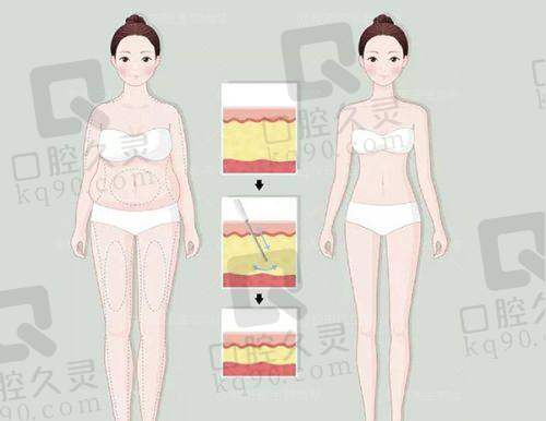 二、克拉美整形医院的擅长项目与技术优势