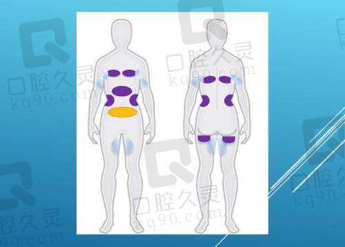 三、克拉美整形医院的口碑与实例分享