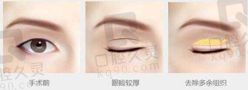 成都美茵医疗美容之其他特色项目