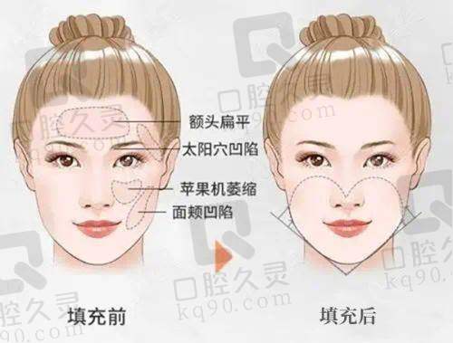 如何根据需求选择西安西美排名靠前的整形医生？