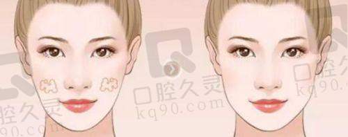 三、上海丽质整形医院口碑如何？不妨来看集美们的实例评价
