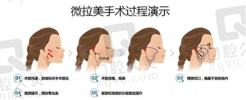 五、成都华 西医院整形预约分享与经验总结