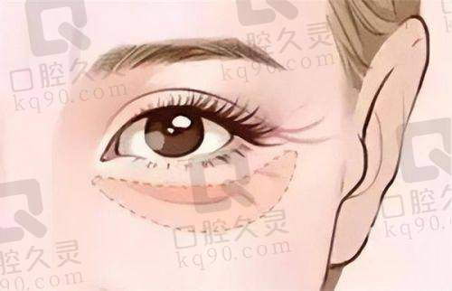 遵义红花岗红美医疗美容门诊部咋样？从排名、技术、口碑和优势全面了解