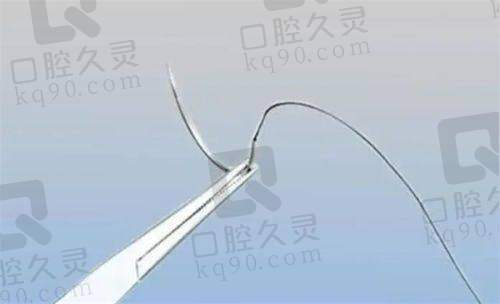雷中元医生的客户口碑