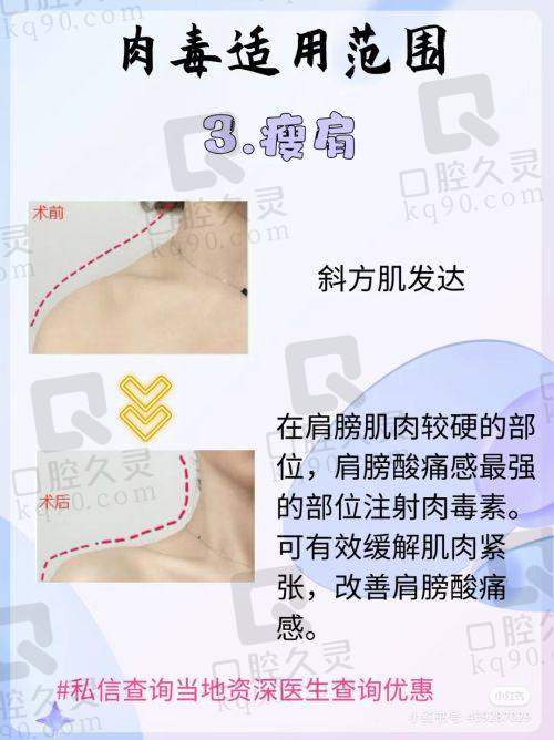 唐莹医生特色技术优势