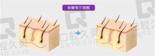 三、韩国高兰得整形医院的客户口碑如何不妨来看集美们的实例评价