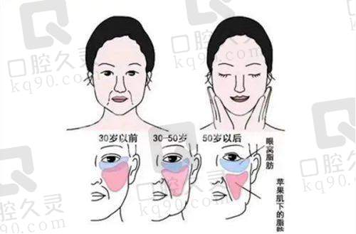 深圳鹏程医院川字纹打玻尿酸价格包含哪些费用？