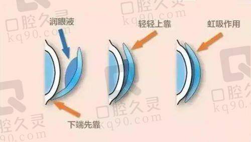 对未来西安四院眼科发展的展望