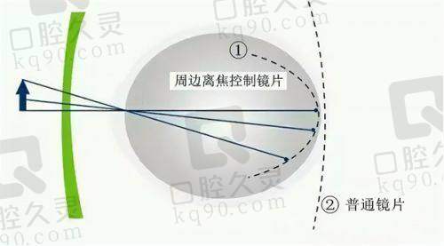 郑州美视美康眼科医院是三等甲吗？患者对它的评价如何