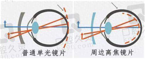 贵州晶朗眼科医院正规吗多少钱？正规医院有价格表参考，暑期还有全飞秒、白内障优惠