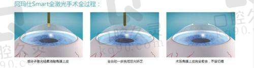 西安四院眼科价格表详细解读