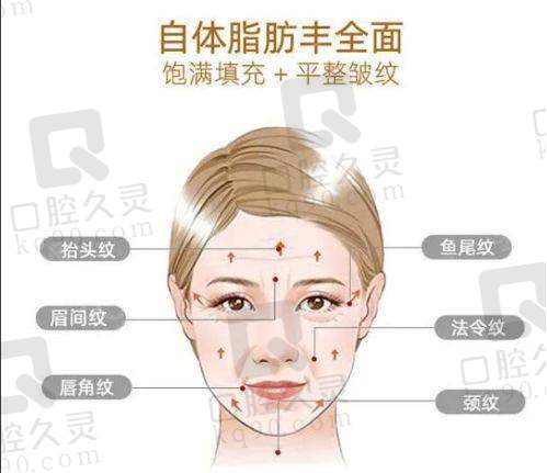 广州去疤美容医院排名靠前的都有哪些？