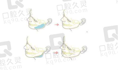 成都中医 大银海修复馒化脸的“可视化超声检测”有何优势？