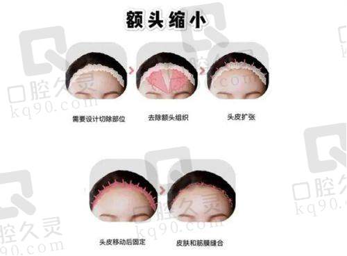 一、郑州羽中整形医院，详细介绍医院资料、资质、成就和擅长项目等
