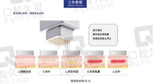 五、北京黄寺罗焕琴伊诺锶黄金微针面部项目的成效与反馈