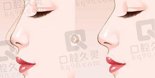 热门整形项目对比