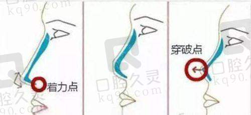 秦皇岛二伟整形美容诊所靠谱吗？1999年成立，设备精、技艺好，还附部分项目价格