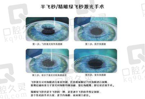 合理的手术价格：满足不同患者的需求