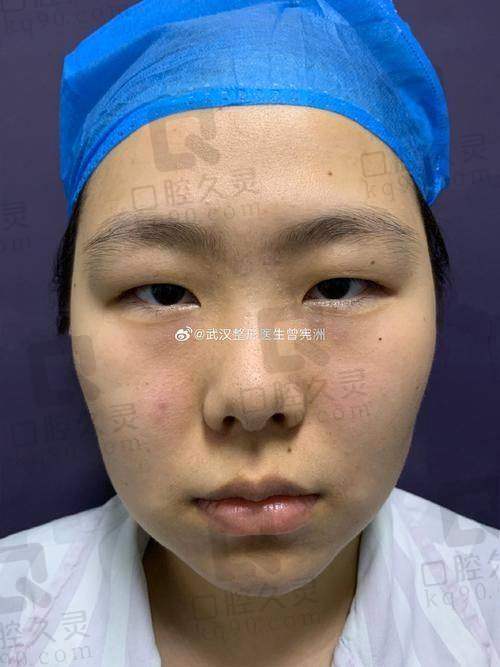 二、梁杰医生火在哪？“上万例手术”不是吹出来的！