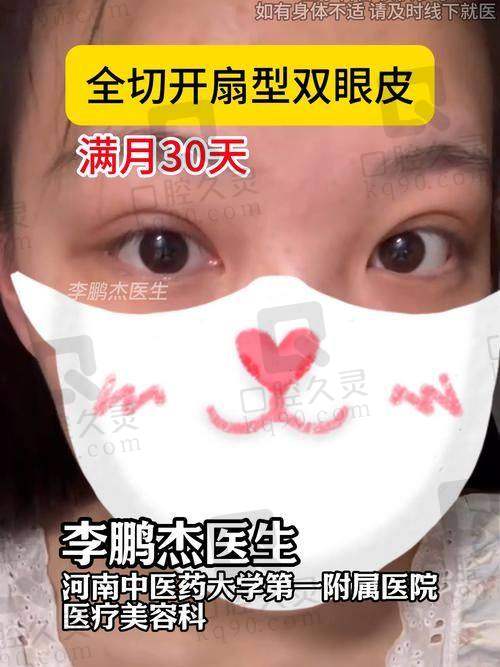 成都中医大银海医美双眼皮怎么样？银海星光眼让眼神灵动有神 升级技术优势尽显 