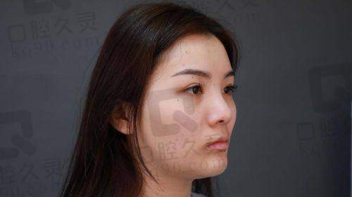 一、北京马静医生简介