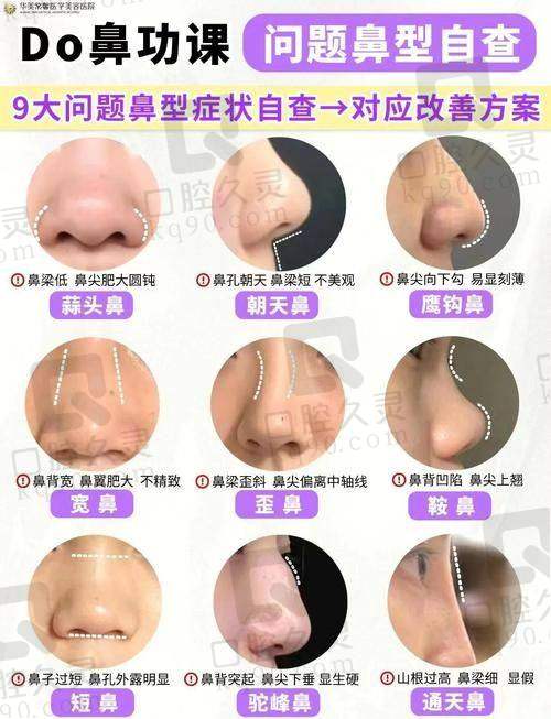 三、洪春医生鼻修复技术优势分析