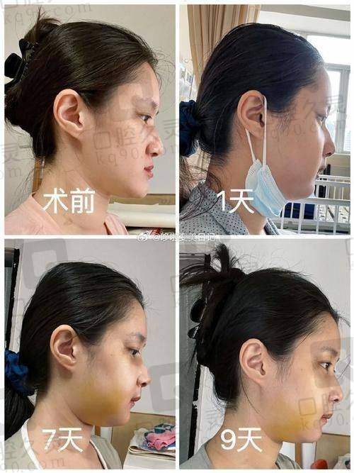 总结