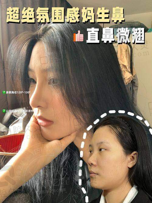 深圳鹏程鼻综合整形的就诊过程是怎样的？