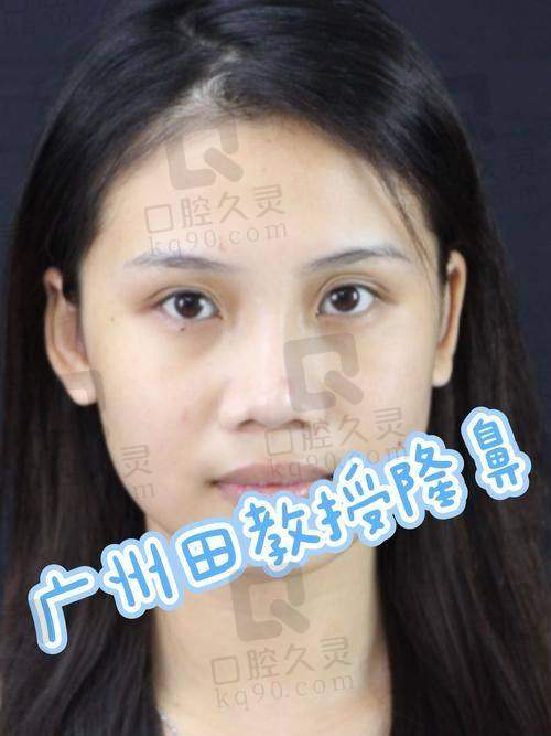 深圳鹏程鼻综合整形有哪些医生？