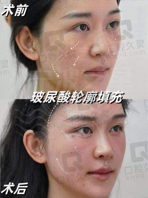 吴闯（武汉市第一医院整形外科）