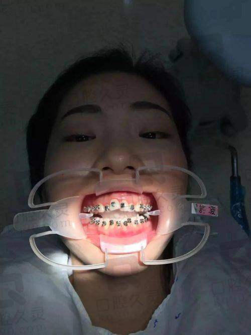 广州壹加壹医疗美容医院矫正牙齿怎么样?医院牙齿矫正技术分析与用户评价,实力医生团队和透明价格让您满意