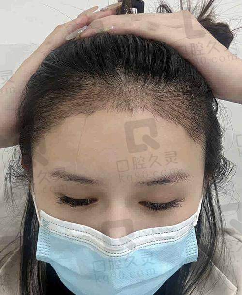 太原碧莲盛医疗美容诊所（植发专科）营业时间