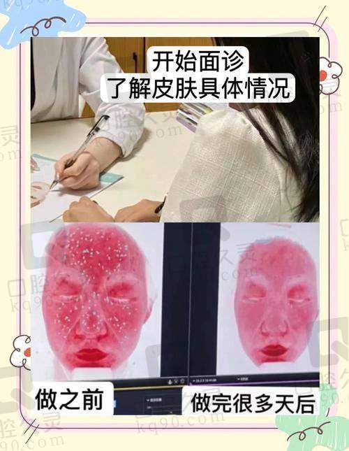 黄金微针的独特优势