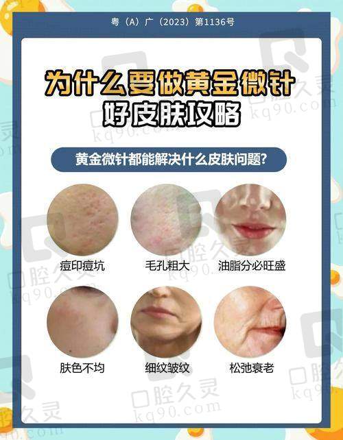 武汉美莱黄金微针价格