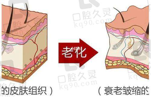 面部注射抗衰的详细过程
