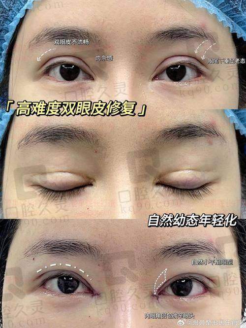 一、哈尔滨瑞丽整形双眼皮修复医院概况