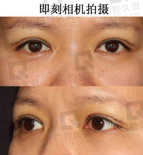 五、哈尔滨瑞丽整形医院医生预约挂号攻略