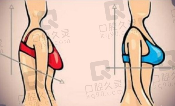 杭州整形医院孙豪医生怎么样?隆胸吸脂腹壁整形技术成效及口碑深度解析