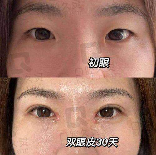 杭州艺星杨连华医生简介
