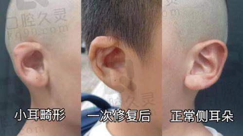 特色祛疤医院的独特技术是什么？