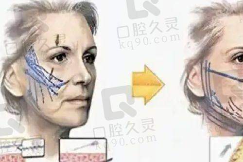 总结